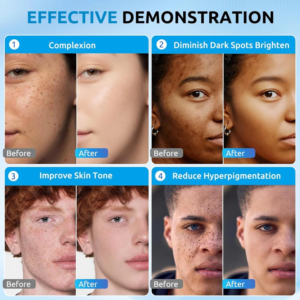 Hanywil Dark Spot Correcting Serum