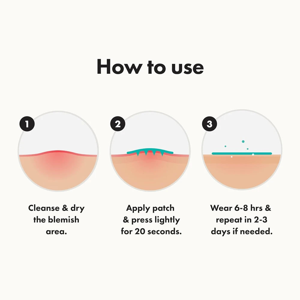 Mighty Patch Micropoint Blemish Treatment