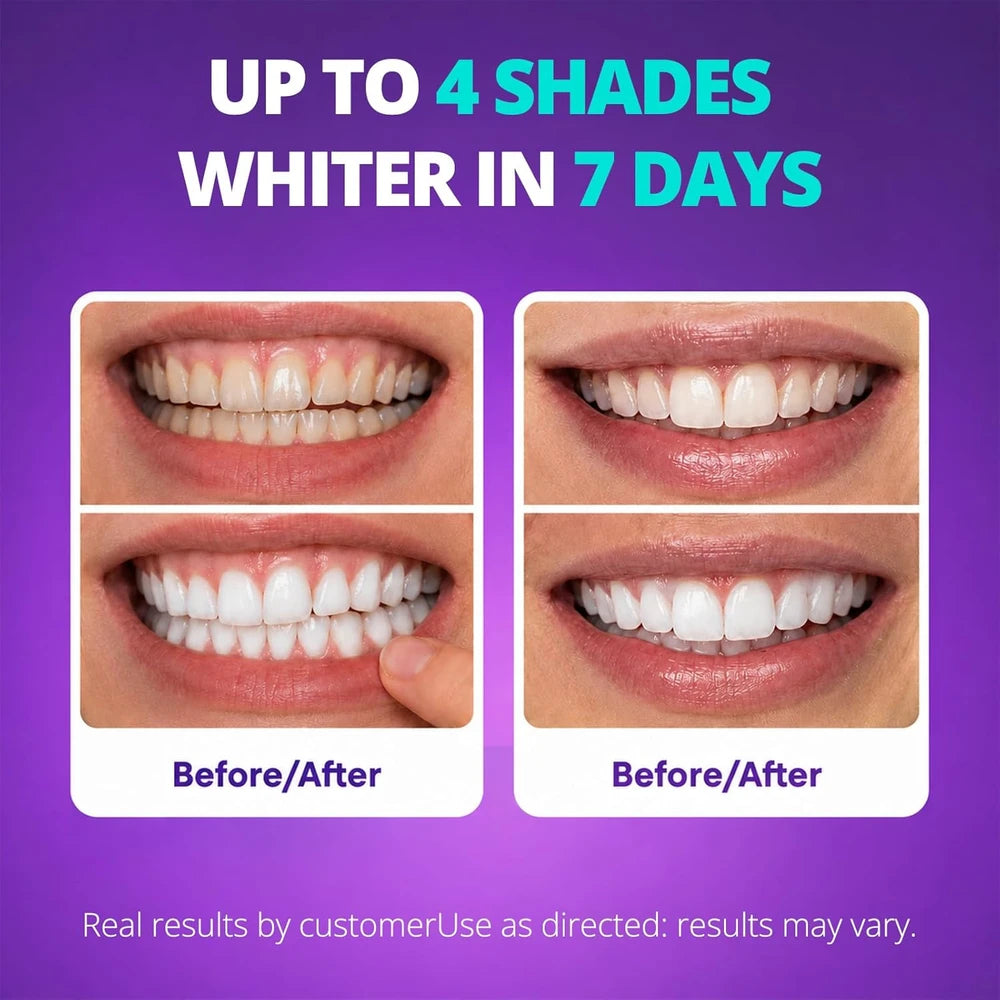 Sakyproral Purple Teeth Whitening Strips